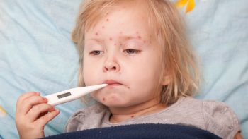 Measles Resurgence in 2025: A Public Health Crisis Unfolds