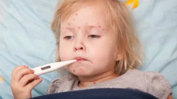 Measles Resurgence in 2025: A Public Health Crisis Unfolds